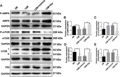 Long-term oral administration of naringenin counteracts aging-related retinal degeneration via regulation of mitochondrial dynamics and autophagy